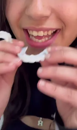 #فينير_متحرك #فينيرز_الاسنان #snaponsmile #فينيرز 