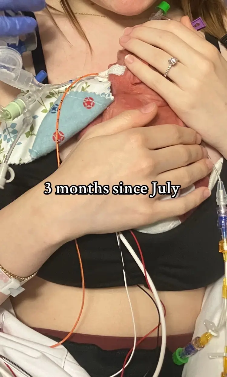 Was that lowkey traumatizing for anyone else to see?? like he was sooo tiny idk how I was okay.  #nicu #micropreemie #preemie #newborn #momtok 