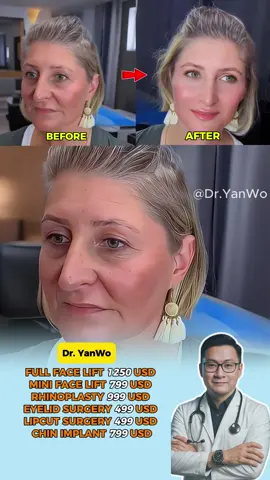 Thank you to the customers who have always trusted Dr. Yan Woo #dryanwoo #facelift #eyelids #necklift #rhinoplasty 
