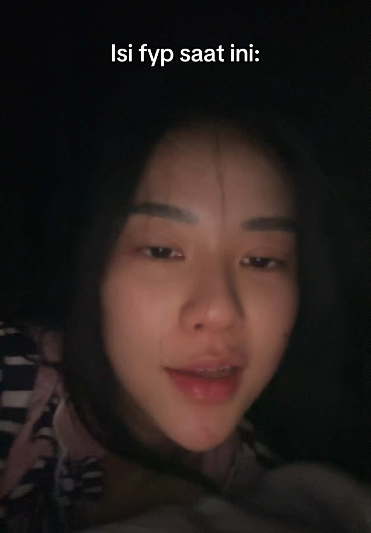 Kenapa muka Erwin kyk telor rebus ya klo bgn tidur