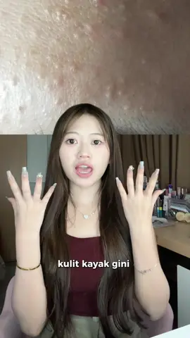 Kulit kaya gini pake apa ya #cerrynabeautytips 