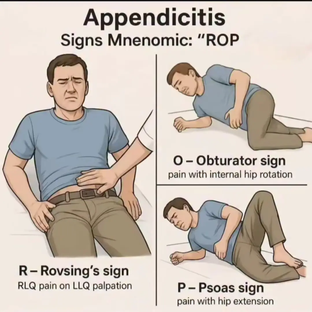 #Appendicitis 