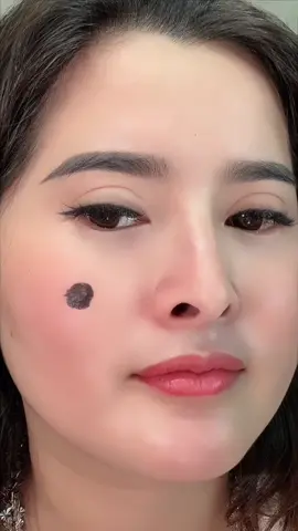 Da sạch đồi mồi, nhìn trẻ liền
