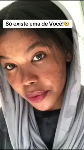 #Tratamentocapilar #Crescimentocapilar #Cabelocrespo #foryoupage❤️❤️ Partilha!