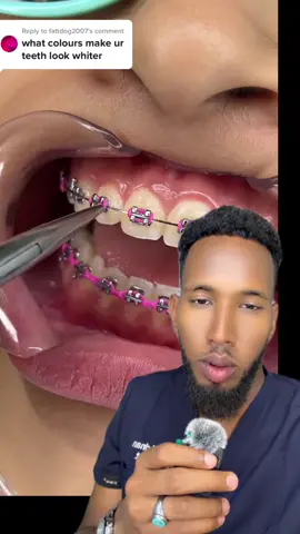 #dentist #aligners for teeth