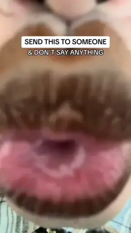 #gothefuckaway #cuddlescuntry #florida #352 #cringecoalition 