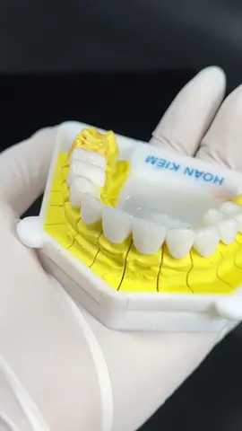Cảm nhận vẻ đẹp tinh khiết trong từng chiếc răng sứ 🦷 #LaboHoanKiem #lamrangsu #rangsuthammycaocap 