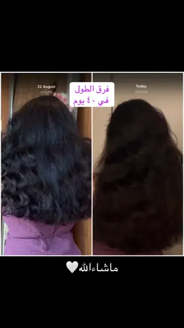 اللي كان ياخذ سنة، صار ياخذ شهر بس 😭✨ شوفوا الفرق بنفسكم! 🤌🏽🍀  #creatorsearchinsights #HairGrowth #InfusedHairGrowthOil #ScalpOil #beforeafter #HairCare #HairTransformation #HerbalExtracts #NaturalHair #40DaysResults #تطويل_الشعر #تكثيف_الشعر #زيت_الفروة #عناية_بالشعر #شعر_طويل #شعر_كثيف #نتيجة_٤٠_يوم #مقارنة_شعر #روتين_شعر #خلاصة_اعشاب #اعشاب_للشعر #CapCut 