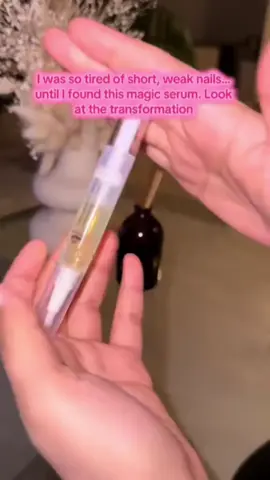 Best nail growth serum I’ve ever tried 😍✅#nails #nailgrowth #london 