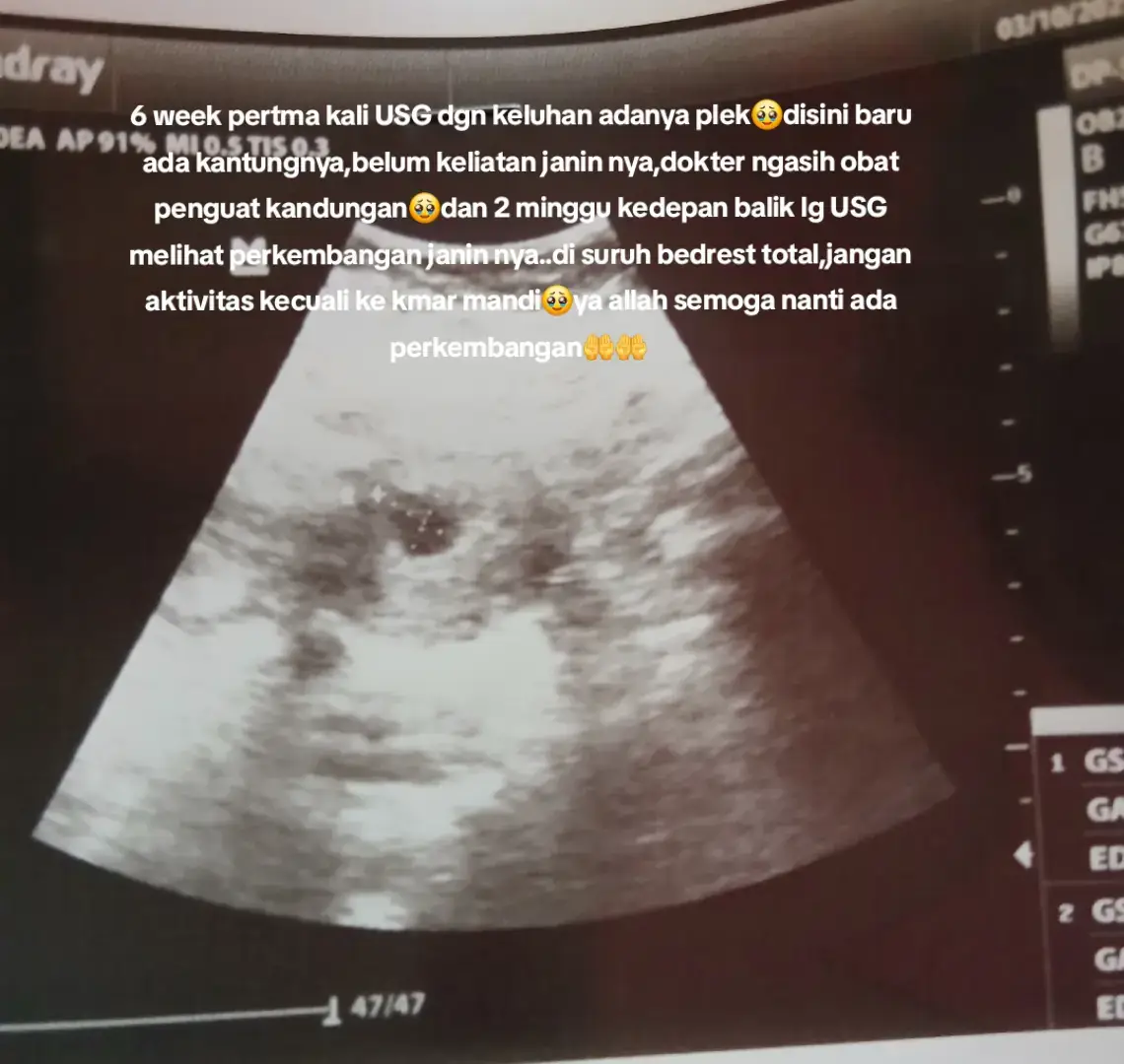 ketemu lagi 2 minggu kedepan ya nak👶 semoga nanti ada perkembangan baik🥰