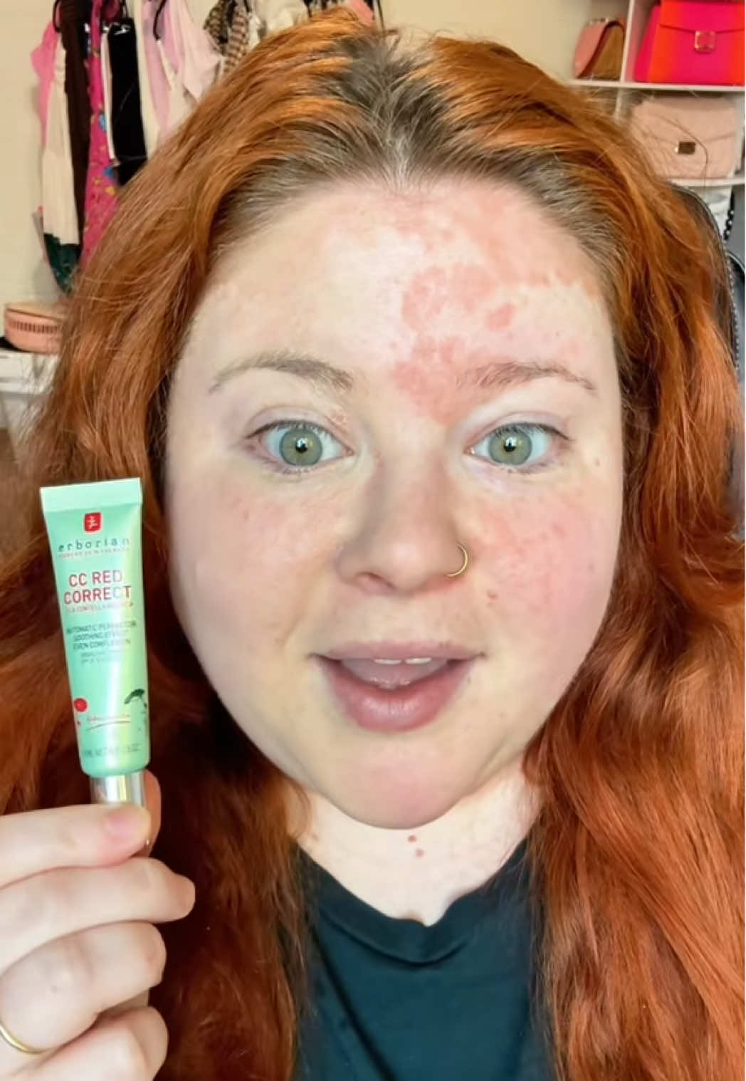 This has been my holy grail for awhile now. I even upgraded to the big tube 😍 If you’re looking for makeup to cover psoriasis then this is the way to go!  @ErborianUSA #redcorrector #psoriasis #rednessrelief #erborian #makeup 