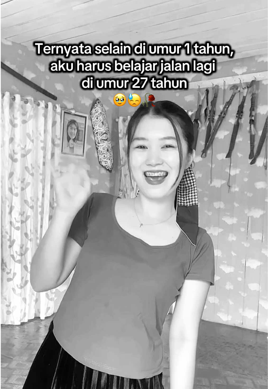 Manusia seceria dan seaktif ini harus merasakan fraktur tibia fibula. Puji Tuhan semua bisa di lewati proses nya😇