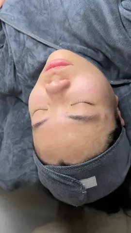 📌Peel Tảo Lạnh CHRISTINA 4A ,loại peel vật lý khiến bao người đẹp phải mê😍 📌Căng bóng, trẻ hóa, không bong😍 📌Hiệu quả sau liệu trình Peel tảo lạnh Christina  *   Giảm mụn ẩn, mụn đầu đen *   Giảm sừng, giảm tiết dầu đáng kể *   Sạch sâu lỗ chân lông, thông thoáng cổ nang lông *   Làm sáng và căng bóng da  #PeelTaochristina  #chamsocdakhoahoc  #xuhuong 