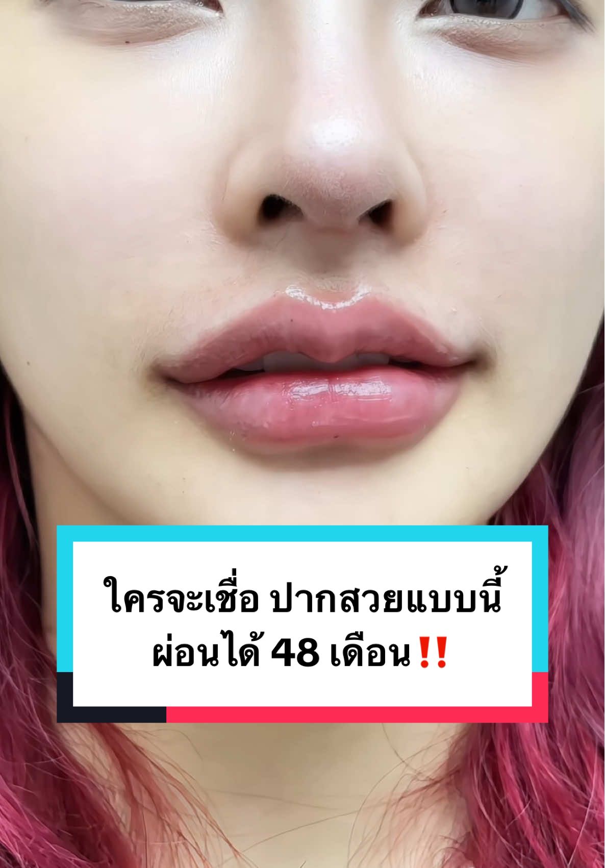 รู้ยัง! ทำฟิลเลอร์ปากที่ออร่าวันนี้ ผ่อนได้สูงสุด 48 เดือนแล้วนะ🥺🩵 #fyp #fypシ #รีวิวบิวตี้ในtiktok #รีวิวสกินแคร์ #รีวิวบิวตี้ #รีวิวคลินิก #รีวิว #รีวิวของดีบอกต่อ #fyppppppppppppppppppppppp #fypage #รีวิวฉีดหน้า #รีวิวฟิลเลอร์ #ฟิลเลอร์ปาก #ปากสวย #ปากกระจับ #ปากบาง #ปากสายฝอ #สายฝอ #ปากสายเกา #สายเกา #ปากจีน #สายdouyin 