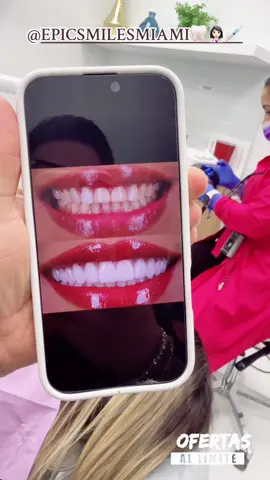 Epic Smile Miami es la clínica dental donde tu sonrisa es nuestra prioridad  🦷 Contamos con ofertas únicas, precios increíbles y un equipo de profesionales listos para atenderte con rapidez , dedicación y cariño. ¡No lo dudes! Ven y vive la experiencia Epic Smile Miami , calidad , confianza y una atención a otro nivel. Comunícate con nosotros y agenda tu cita hoy mismo @EPIC SMILES MIAMI 🦷 👩🏻‍⚕️💉 !! #SonrisaPerfecta #DentistaEnMiami #OfertasDentales #CuidadoDental #MiamiSmiles #DentistaProfesional #OdontologíaMiami #SaludDental #SonrisaRadiante 