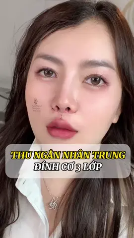 Thu nhân trung hạn chế giãn sẹo @an #nhantrung #thunhantrung #fyb #viral #xuhuong