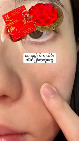 #Moelay #အဆီပြန်အဆီဖုသမားများအတွက် #hcသလဲသီးမျက်နှာသစ်ဆပ်ပြာ #မန်းလေးမြို့တွင်းအိမ်အရောက်ပို့ပါတယ် #fyppppppppppppppppppppppp 