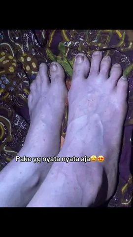 #hbpemutih#hbpenutihbadan #hbpengelupas 