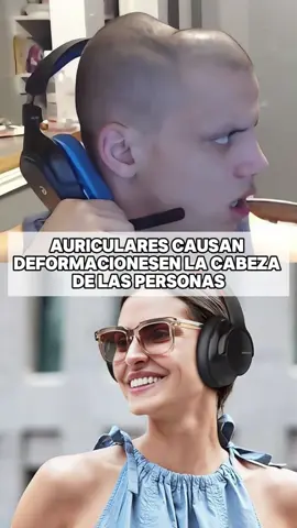 AURICULARES CAUSAN DEFORMACIONES EN LA CABEZA DE LAS PERSONAS#news #breakingnews #Headphones