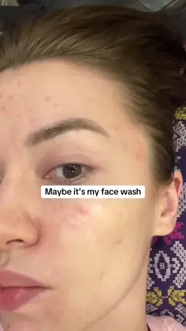 Cut the sugar and your skin clears. #fyp #skincare #Skincareroutine 