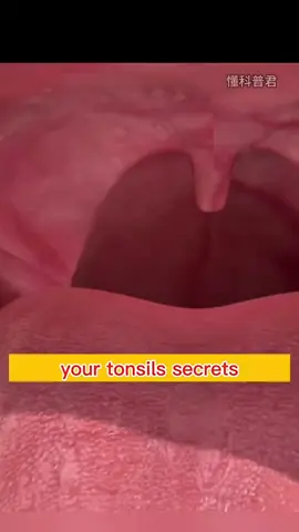Tonsils Warning Signs You Ignore 😨 ⚠️