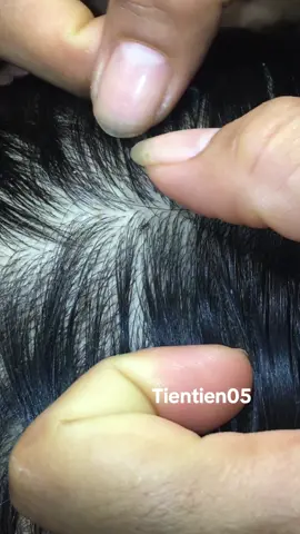 Remove lice 