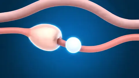 Twins Baby inside view in Mother  #anatomy #viral #foryou#human#healthylifestyle#shorts ‎