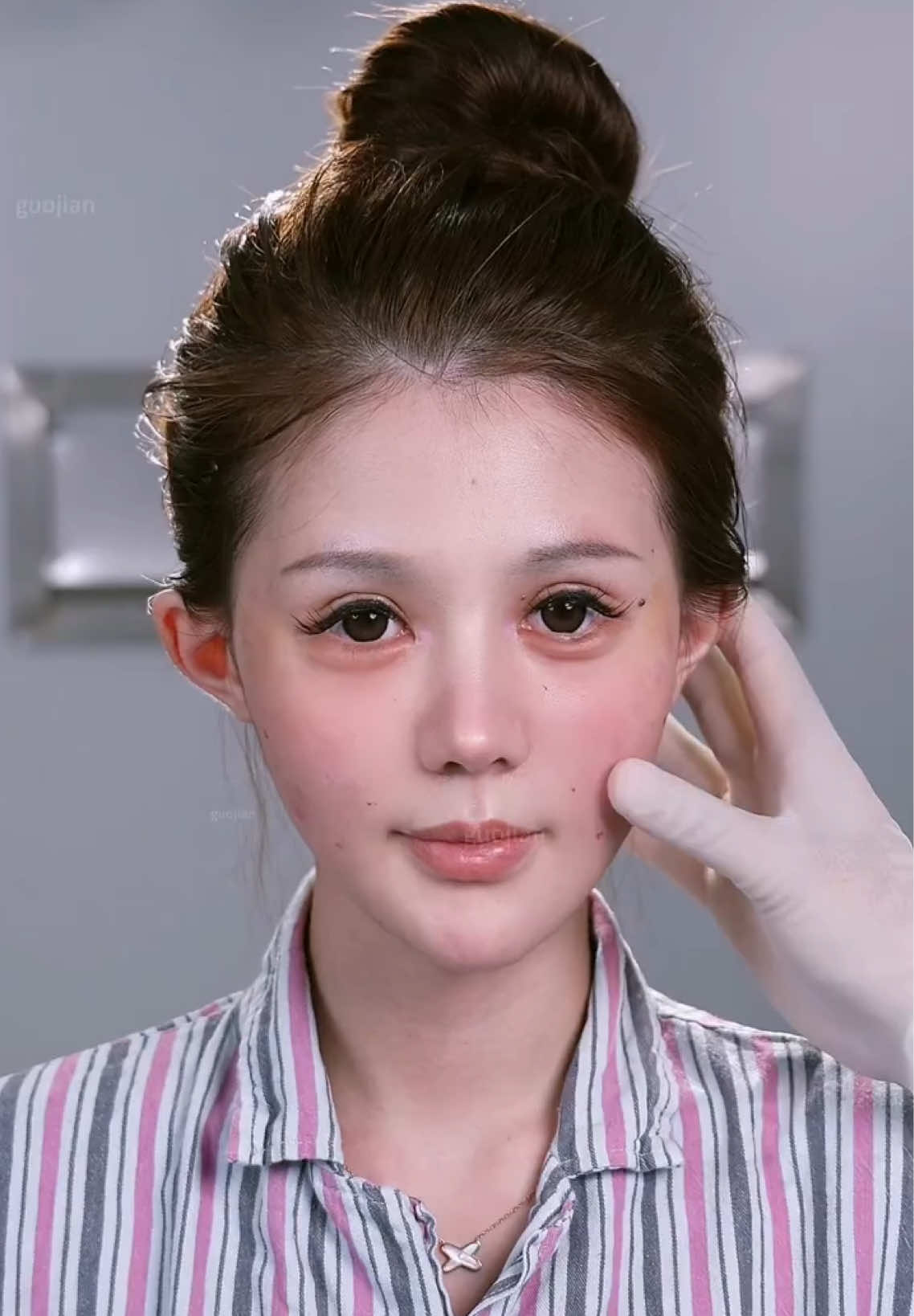紧致V脸#fypシ #facelift #facelifting #smaslifting #beauty 