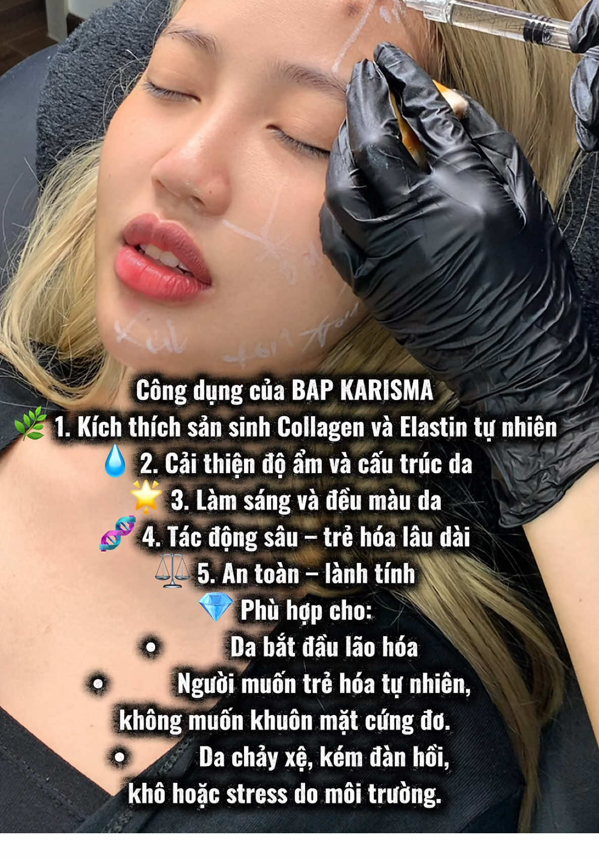 Công dụng của BAP KARISMA 