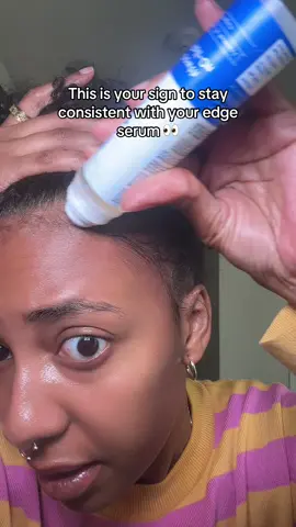 No magic. Just consistency — and Bodywise. #EdgesOnTheWay #HairGrowthRoutine #TikTokShopFinds #haircare #hairserum 