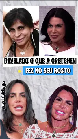 Gretchen Surge Com Novo Rosto | gretchen atualmente 2025 | rosto da Gretchen #gretchen #novorosto #canaldodiego 