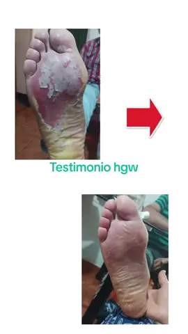 Una crema dental a base de hierbas chinas que protegen tu boca, y el resto de tur cuerpo. la más vendida de hgw. Si Tienes dudas pruebala, no volverás a las cremas tradicionales nunca más.  #testimoniohgw #emprendehgw #hgw #naturalmenteesmejor💚 