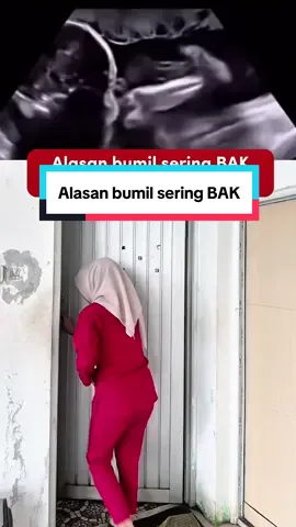 Ini nih bun penyebab bumil sering BAK🫢😁 #fyp #dokterkandungan #edukasibumil #edukasibidan #viraltiktok 