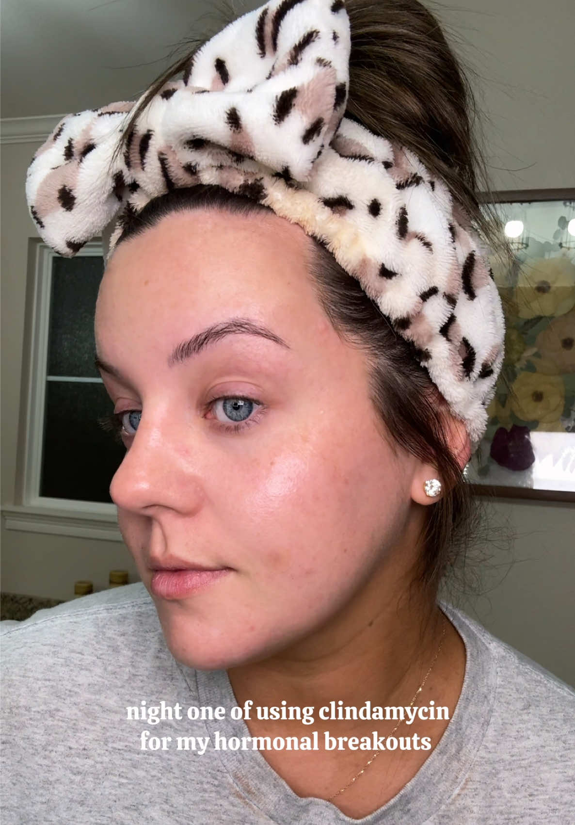 swtitching the benzoyl peroxide cleanser to the morning instead of evenings but keeping it simple 🤍🫧🧴  @Farmacy Beauty Cleansing Balm @CeraVe 4% Benzoyl Peroxide Cleanser @Bubble Skincare Cosmic Silk Milky Toner •Clindamycin  @cocokind Magnesium Calming Mist, Electrolyte Water Cream, Ceramide Lip Balm  #nighttimeskincare #clindamycin #skincareroutine #acneproneskin #CapCut 