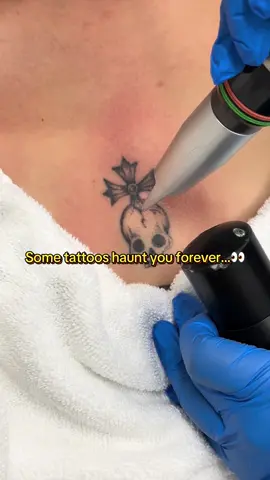No tricks-just fast, powerful fading. Say goodbye to haunting ink… and hello to fresh skin! 🎃 #laserhairremoval #satisfying #dmv #fyp #tattoolover