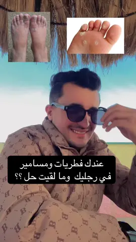 هذي وصفة معروفة وفعّالة 👣: 🔹 الفوائد: 	•	تعقيم القدمين من البكتيريا والفطريات. 	•	إزالة الروائح الكريهة. 	•	تليين الجلد الميت وتشقق الكعبين. 	•	تهدئة التعرق الزائد. 🔹 طريقة الاستعمال: 	1.	سخّن ماء (يكون دافئ يتحمل الجلد مش يغلي). 	2.	أضف: 	•	نصف كوب خل أبيض أو خل تفاح. 	•	2 ملعقة كبيرة بيكاربونات الصوديوم. 	3.	انقع رجليك في المحلول 15–20 دقيقة. 	4.	بعدين نشّفهم مليح، ويفضل دهنهم بزيت مرطب (زيت الزيتون أو الفازلين). ⚠️ ملاحظات: 	•	ما تستعملش الوصفة يوميًا، يكفي مرتين في الأسبوع. 	•	إذا عندك جروح مفتوحة أو تشققات عميقة، ما تستعملش الخل لأنه يلسع #الاكسبلور 