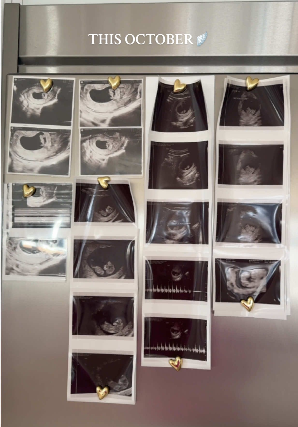 our greatest blessing!! 🌈🪽👼🏻 if you’ve ever gone through or are currently going through something similar, know that you’re not alone & there is hope 🤍 #miscarriage #miscarriageawareness #pregnancy #rainbowbaby #angelbaby 