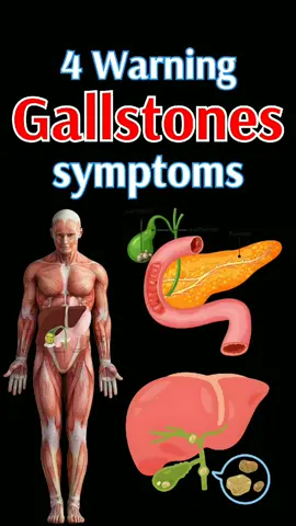ً4 Warning gallstones symptoms #gallstones #gall  #guthealth #digestion #health 