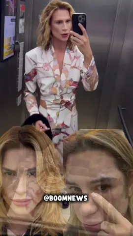 Morte de Júnior Dutra choca fãs após procedimento estético#noticias #luto🖤 #morteporprocedimento  #polemica  #jornal 