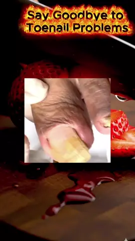 Toenail Treatment #viralvideos #relaxing #Satisfying #satisfyingvideos 