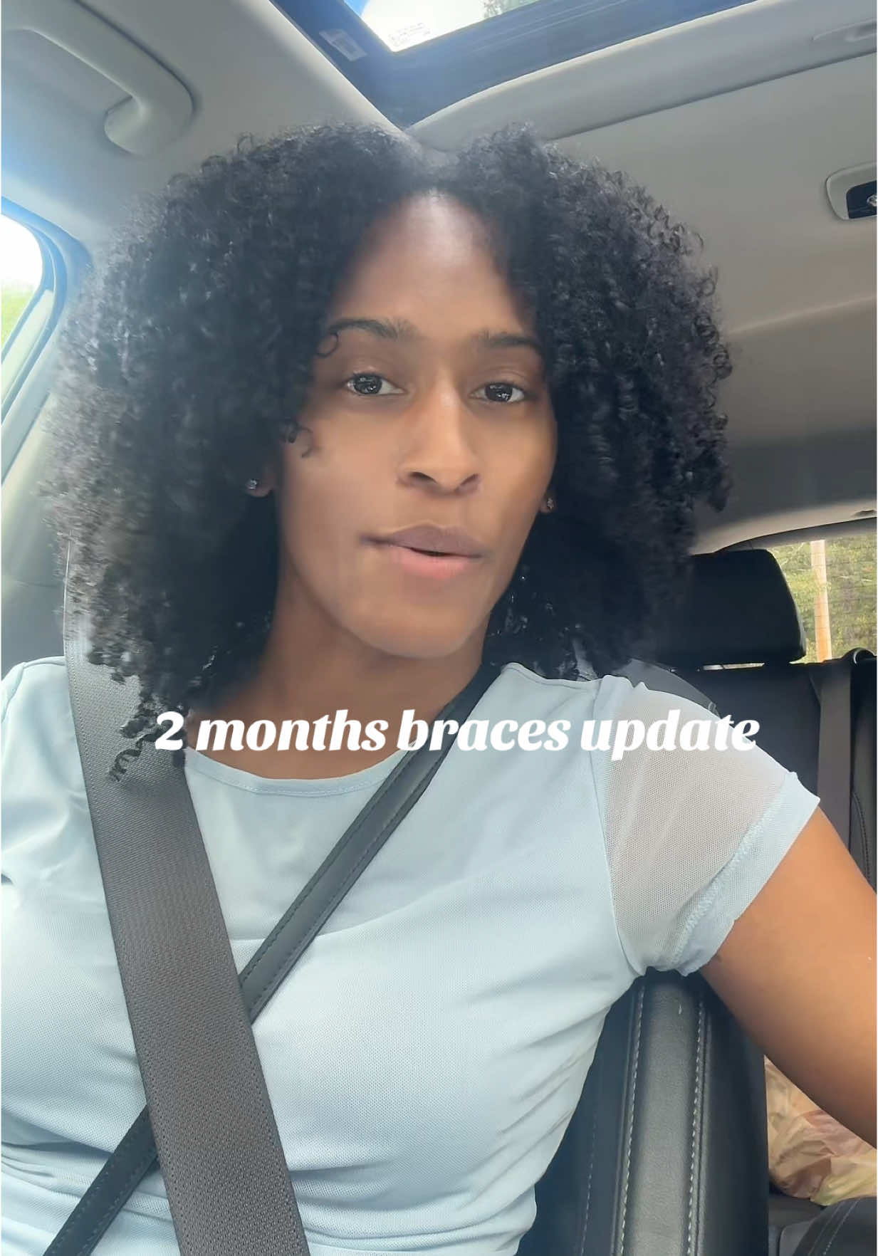 I finally posted lol #braces #lightforcebraces 