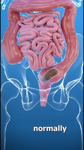 Gummies for digestion #constipation #guthealth #healthygummies #antioxidants #vegan 