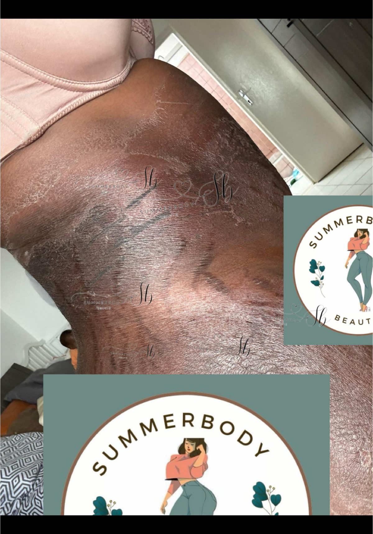 Notre savon peeling est différent de tous ceux que vous avez vus, sans aucun doute. Très efficace et puissant.🥰🥰 vergeture traitement vergeture senegal Vergeture vergeture oil vergetures depigmentation vergeture noir anti vergeture vergeture sur les hanches vergeture rouge vergetures entre les jambes Rew Stretch marks Savon peeling #vergetures #savonpeeling #rew #stretchmarks #exfoliant 