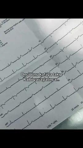 #kardiyoloji #ekg #kalp #keşfet #keşfetteyizzz 