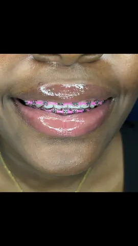 #😍😍 #fashionbracessummer😍😍 #bookyourappointment #whatsapp7651450 