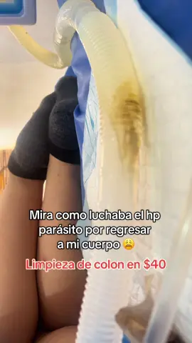 🪱 Los parásitos o lombrices pueden convivir contigo sin que lo sepas hasta por más de 10 años!!! Limpia tu colon con nosotros ✨ #hidrocolonterapia #limpiezadecolon #caca #parasitos #guayaquil 
