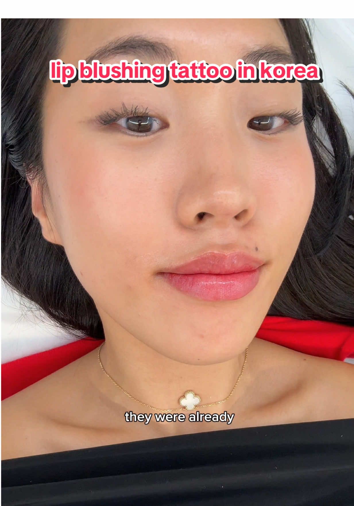 first time getting a lip blushing tattoo and I’m obsessed💋 I went to @ararodite_a.shop in Gangnam (IG) and I’m already thinking of going back for a touchup next year cuz I love how the color turned out haha #lipblushing #lips #liptattoo #lipblushingtattoo #korea   