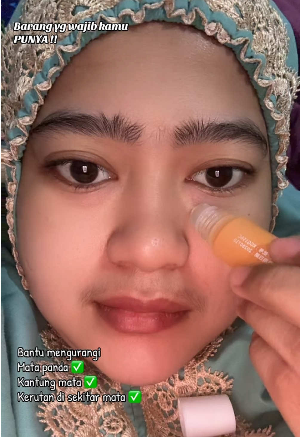 Wajib punya DINKISS ❤️#matapanda #kantungmata #lingkaranhitam #serummata #serumviral 
