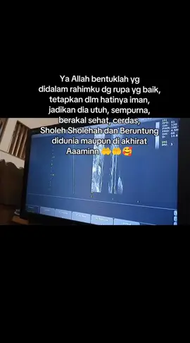 Aaaminn ya Allah ya Rabbal Alamin 🤲💖😘 #fyppppppppppppppppppppppp #hamil #usg 