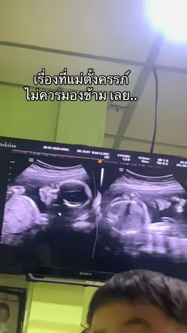 #แม่ตั้งครรภ์ #ทําความสะสะอาด #จุดซ่อนเร้นเป็นเรื่องสําคัญ #มาม่าช้อยส์ #ตกขาว 
